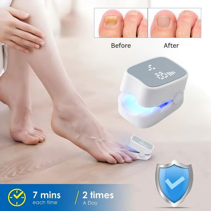 FungeeFree™ - Nail Fungus Laser